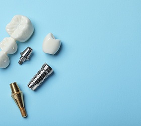 Dental implants are permanent tooth replacement prosthetics